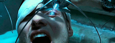 Fotograma de la película Minority Report en el que el recién operado protagonista es supervisado por un robot araña.